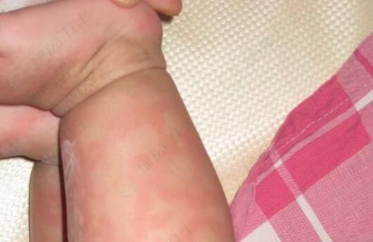 「檢測治理」新房裝修后如何去除甲醛？新房裝修設(shè)計應(yīng)注意什么？